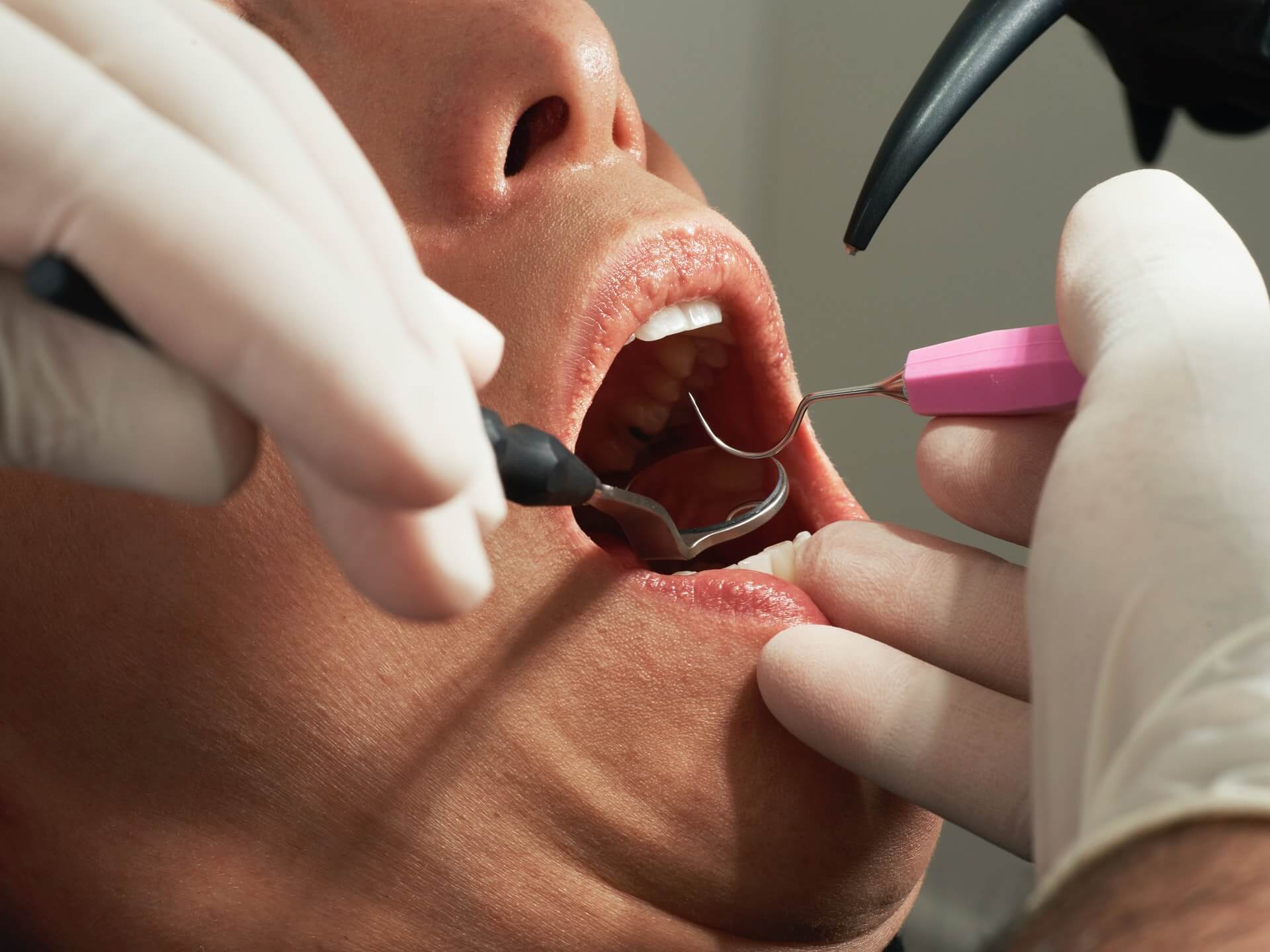Tandarts expat Amsterdam Zeecare Dental
